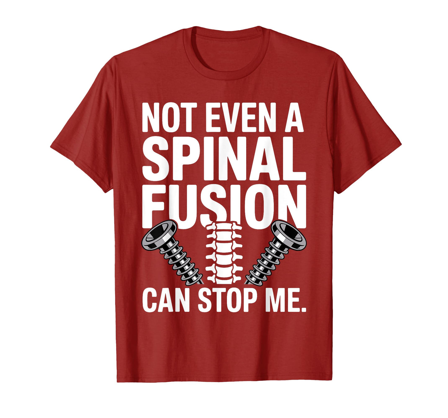 Spinal Fusion Art for Men Women Lumbar Spine Spinal Fusion T-Shirt