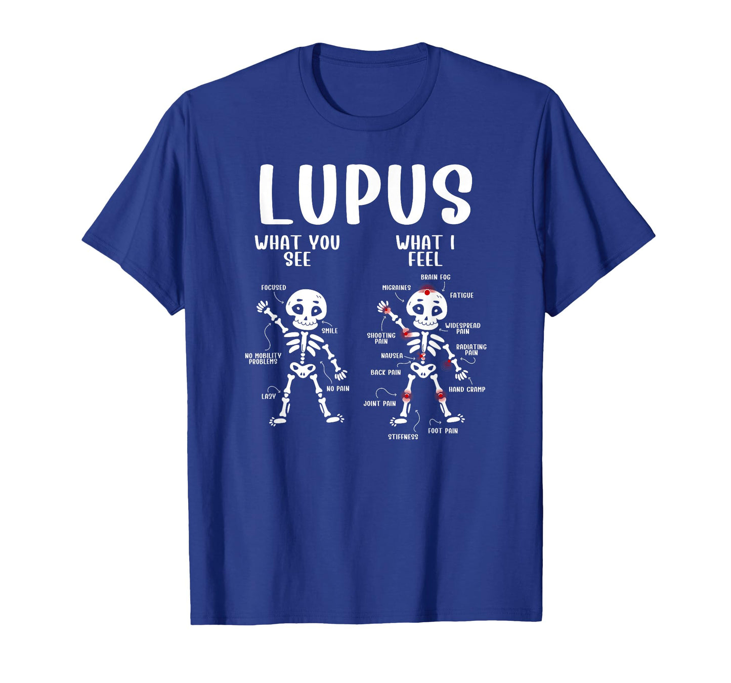 Funny Lupus Awareness Lupus Warrior Lupus Fighter T-Shirt