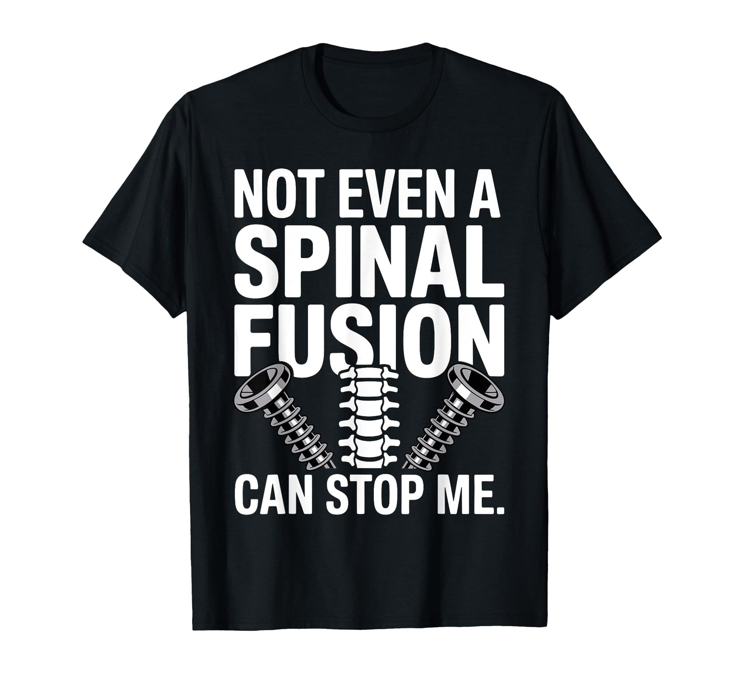 Spinal Fusion Art for Men Women Lumbar Spine Spinal Fusion T-Shirt